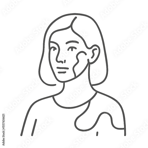 Young woman with vitiligo portrayed in minimalist line art style  