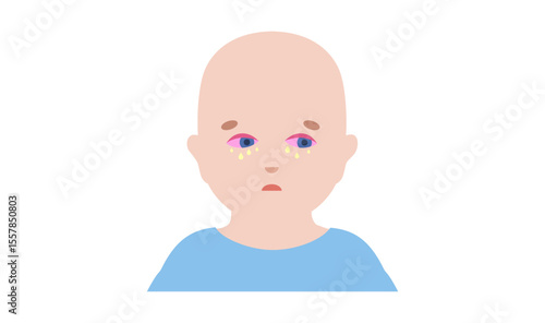 Conjunctivitis medical poster