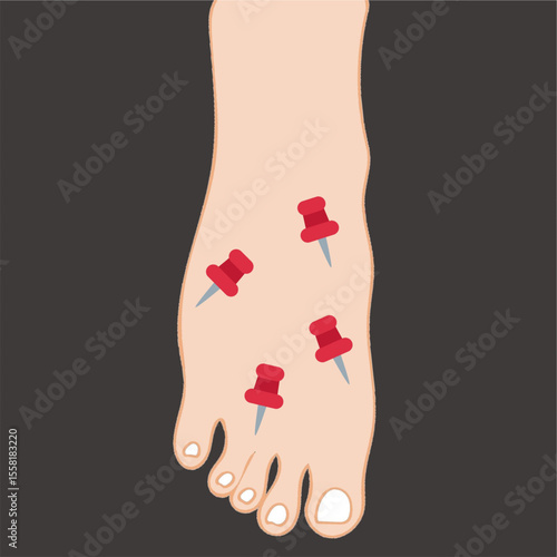 pins and needles symptoms on leg disease concept illustration design useful for medical purposes