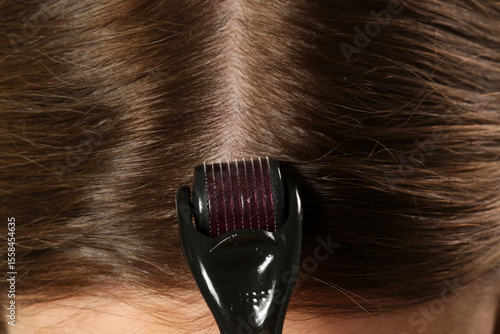 Woman using microneedle derma roller on head for stimulating new hair growth. Simple and cheap treatment for the healthy scalp.