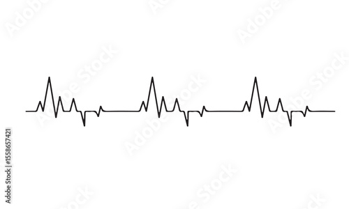 ekg heart beat