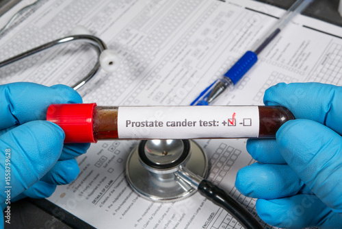 Doctor holding positive prostate cancer test result in hospital