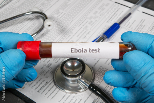 Doctor holding blood sample for ebola test