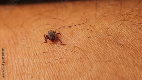 Close-up shot of a parasitic tick crawling on a human hand. A realistic depiction of danger from insect bites and vector-borne diseases, perfect for medical, health, or science projects.