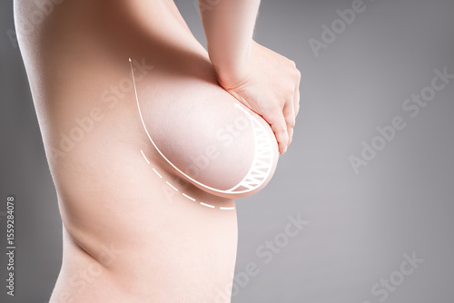 Breasts of different sizes on grey background, reduction mammoplasty, aesthetic plastic surgery, healthcare and medicine concept