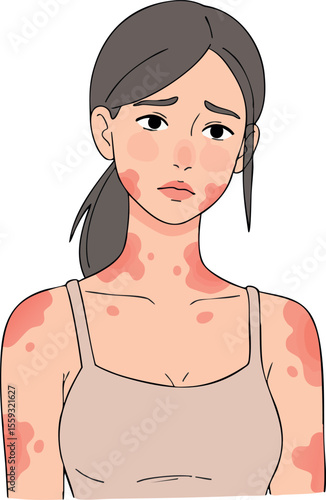 Woman with skin rash showing irritation and discomfort in vector medical health concept illustration