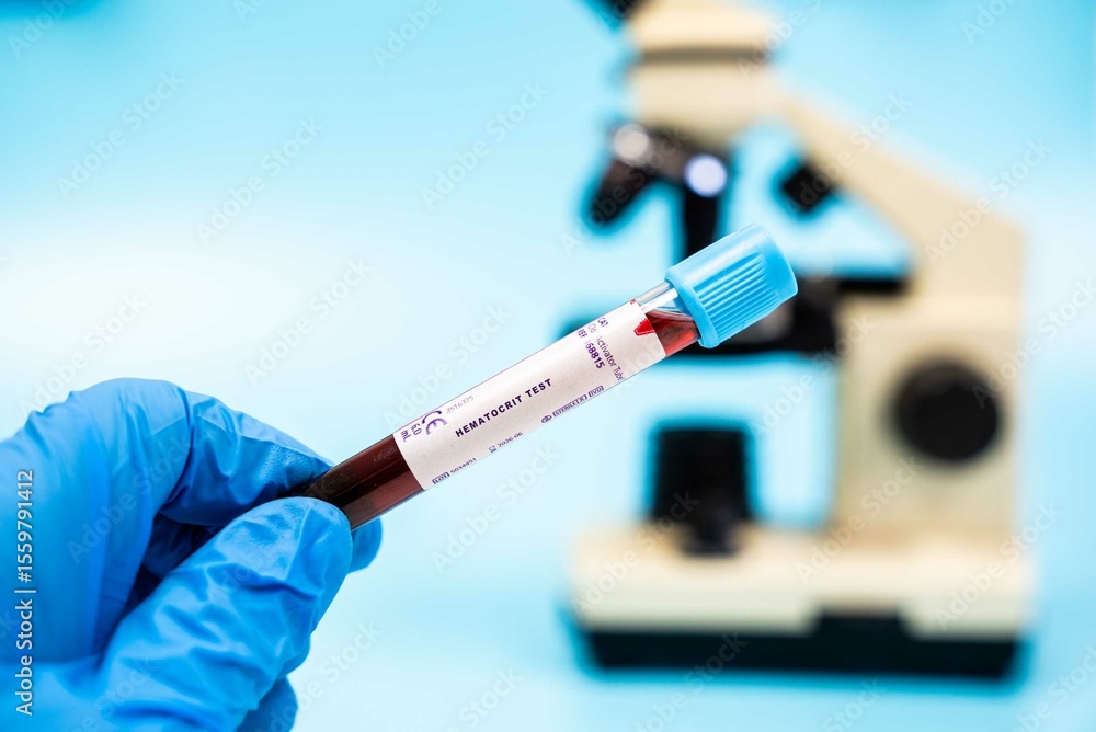 Naklejka premium Evaluates the proportion of red blood cells in blood,