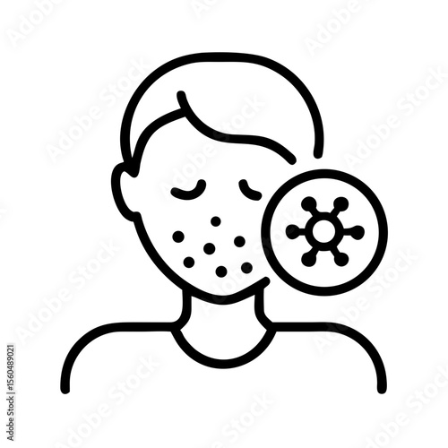 Man showing allergy symptoms with visible rash and germs icon  