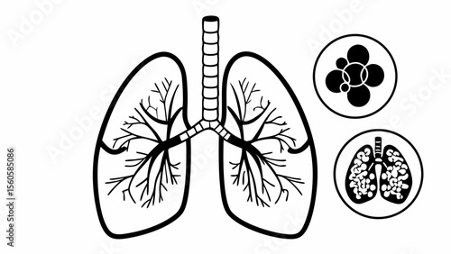 Black and white illustration of human lungs with detailed bronchi and alveoli