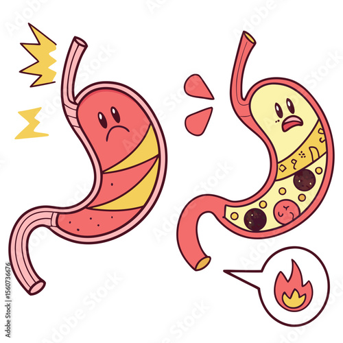 Human stomach. Healthy and unhealthy, Bloating stomach ache, digestive tract pain fullness heaviness stomaches acid heartburn process