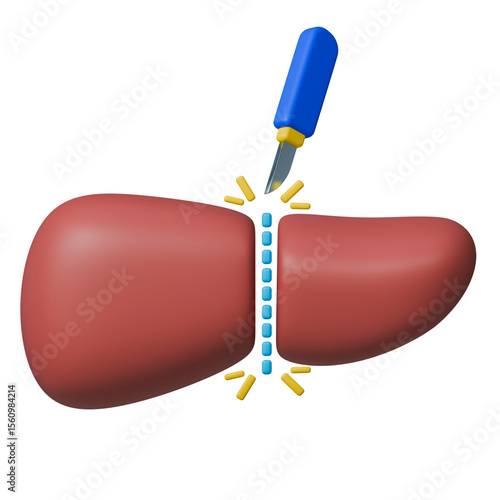 Hepatectomy surgery 3d icon with liver incision and scalpel tool.