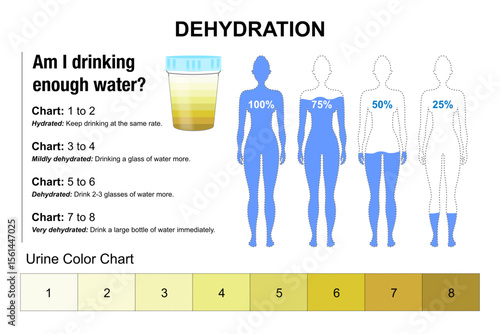 Dehydration - Urine Color signs, symptoms