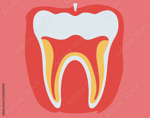Cross section of human tooth with gum inflammation and periodontitis disease in flat minimalist medical vector illustration detailed anatomy of dental pulp and roots