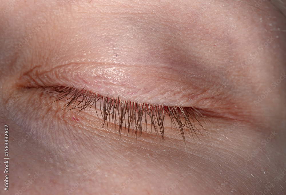 Fototapeta premium Glued eyelashes close up, demodex disease, closed eye