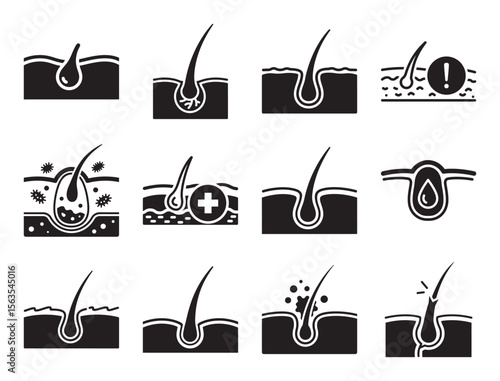 Hair care and treatment solid glyph icon set for follicle and growth showing various stages and conditions for dermatology and cosmetic solutions