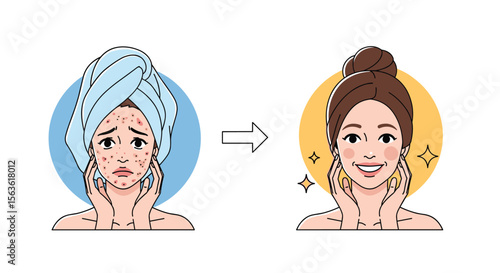 Transforming skin from acne to clarity achieving radiant health through dedicated skincare routines