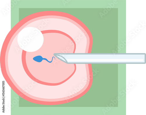 IVF ICSI vector illustration. Perfect for presenting anything about reproduction, insemination or ivf. Green square background.