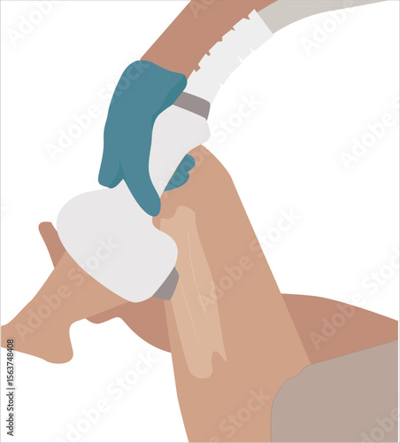 women laser leg hair removal