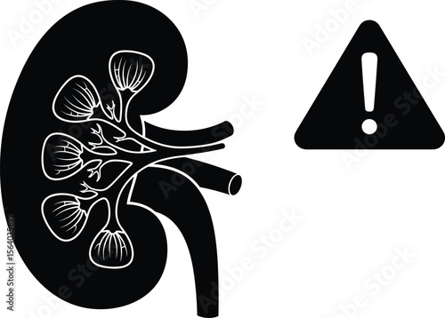 Human Kidney Anatomy Silhouette with Warning Triangle, Symbolizing Kidney Disease, Renal Health Issues, Medical Alert, Organ Failure Risks, and Urological System Concerns