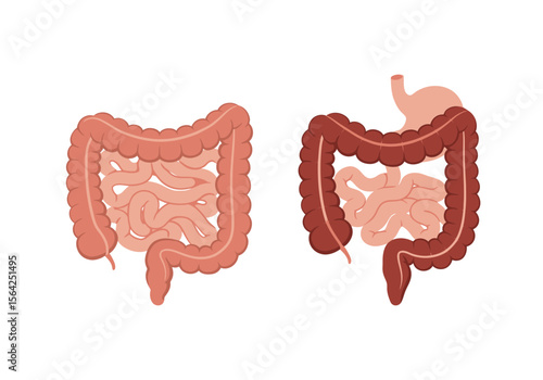 Human Digestive System: Healthy and Inflamed Large Intestine Comparison.