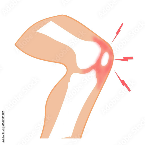 knee pain inflammation illustration redness swelling design science .eps