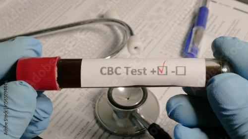 Doctor showing cbc test tube with positive result