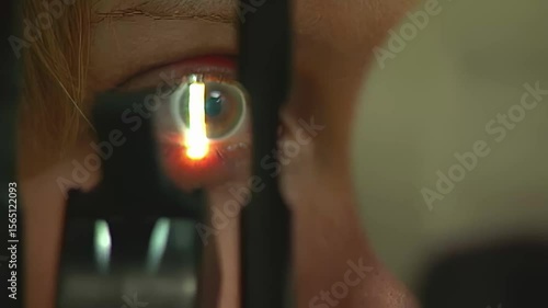 Close-up of a patient's eye undergoing a slit-lamp examination at the eye doctor, highlighting the cornea and iris. Ideal for medical, vision care, or glaucoma awareness projects. 14704	