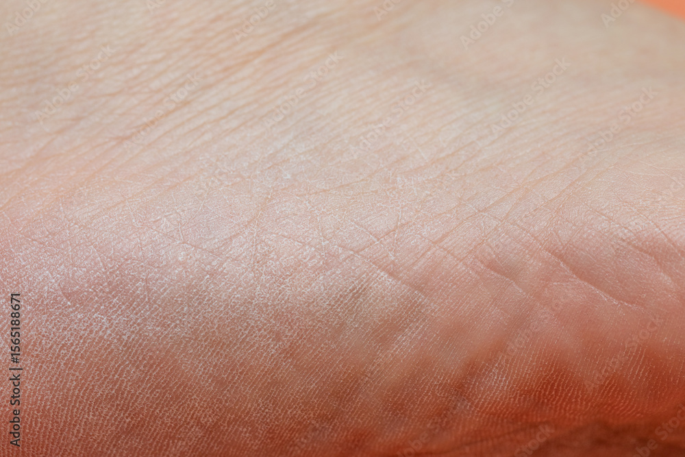 Fototapeta premium Dry skin showing signs of dehydration and damage