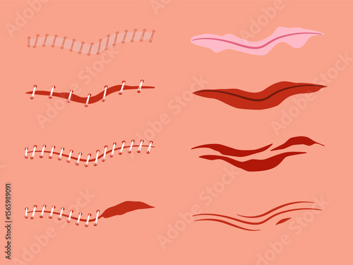 A collection of vector illustrations depicting various types of human skin wounds including scratches scrapes abrasions