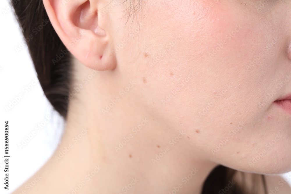 Obraz premium Woman with moles on her face against white background, closeup