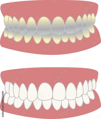 teeth.eps
