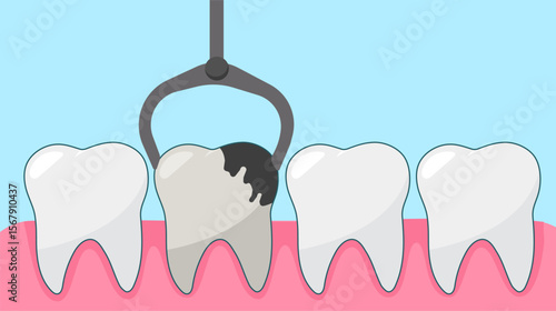 Tooth extraction by dental forceps oral health and dental care vector illustration