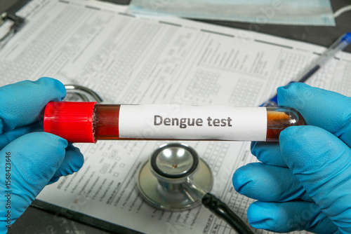 Doctor holding a test tube with blood sample for dengue fever test over medical form and stethoscope