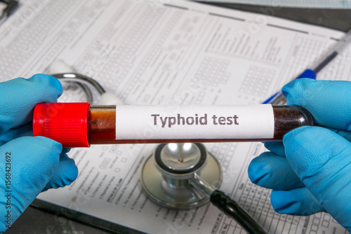 Doctor holding blood sample for typhoid test in laboratory
