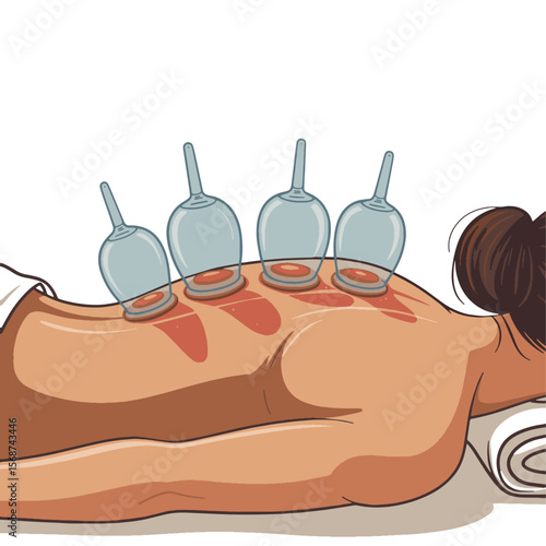 Cupping Therapy Set