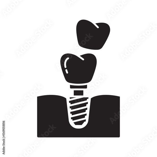 Dental implant placement icon showing tooth restoration surgery process for stomatology prosthetics and artificial molar root replacement treatment vector solid glyph