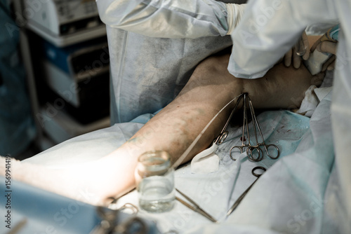 фотографія Close-up of EVLA catheter inserted into varicose vein
