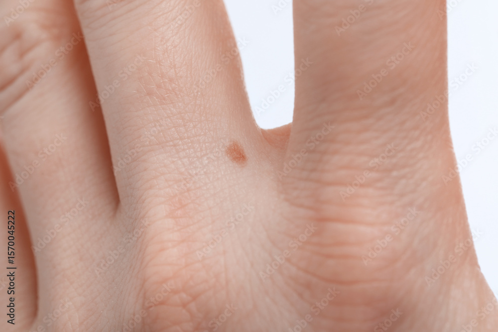 Fototapeta premium Woman with mole on her hand against white background, closeup