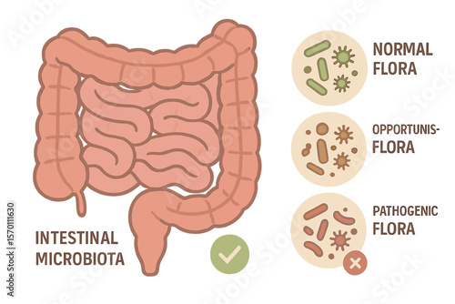 A detailed vector illustration of the small and large intestines is depicted in a realistic flat style, showcasing intestinal microbiota, including normal, opportunistic, and pathogenic flora, as