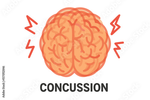 The brain appears to be shaking with multiple brains overlapping, symbolizing a concussion and its effects on the brain, as depicted in this medical illustration of symptoms