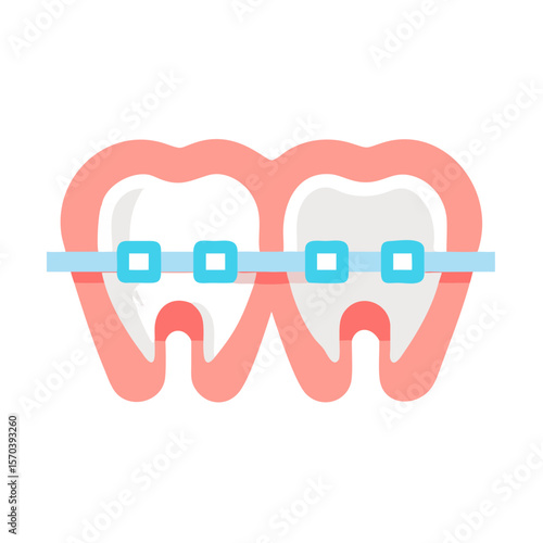 Dental braces on two teeth illustration on White backdrop