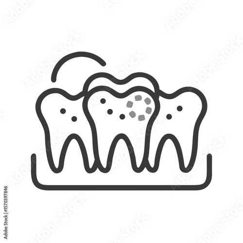 Tooth decay illustration showing dental health problem on White