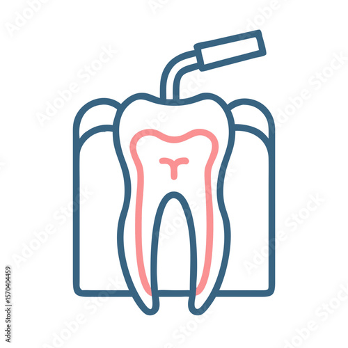 Dental root canal treatment graphic illustration on White backdrop