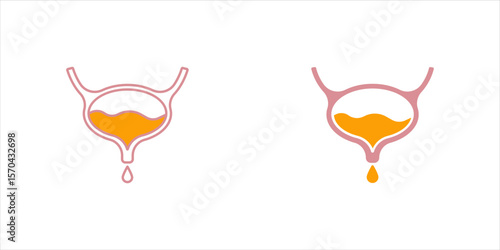 Empty and Full Urinary bladder. Vector cartoon flat anatomical icon color illustration. Bladder isolated on white background. Health care medical sign. Design element for urology.