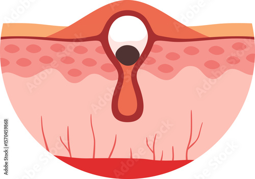 Pimple Skin Problem

