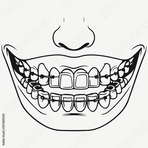 teeth with braces sketch illustration vector