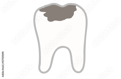 虫歯が進行して痛そうな歯のイラスト