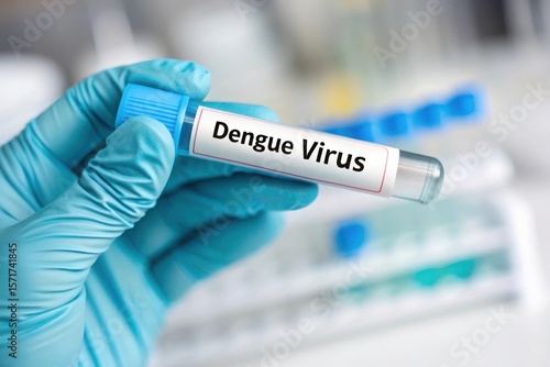 Medical professional holds test tube labeled dengue virus in laboratory setting