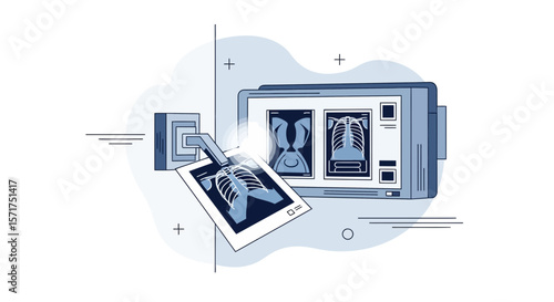 Radiology Machine Analyzing X-Rays To Detect Health Issues In The Human Body