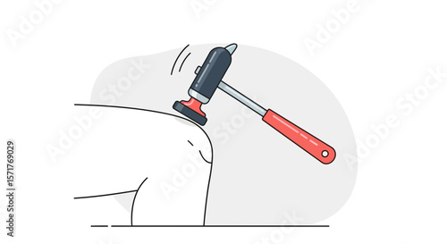 Illustration Of A Knee Being Tested With A Reflex Hammer Neurological Assessment